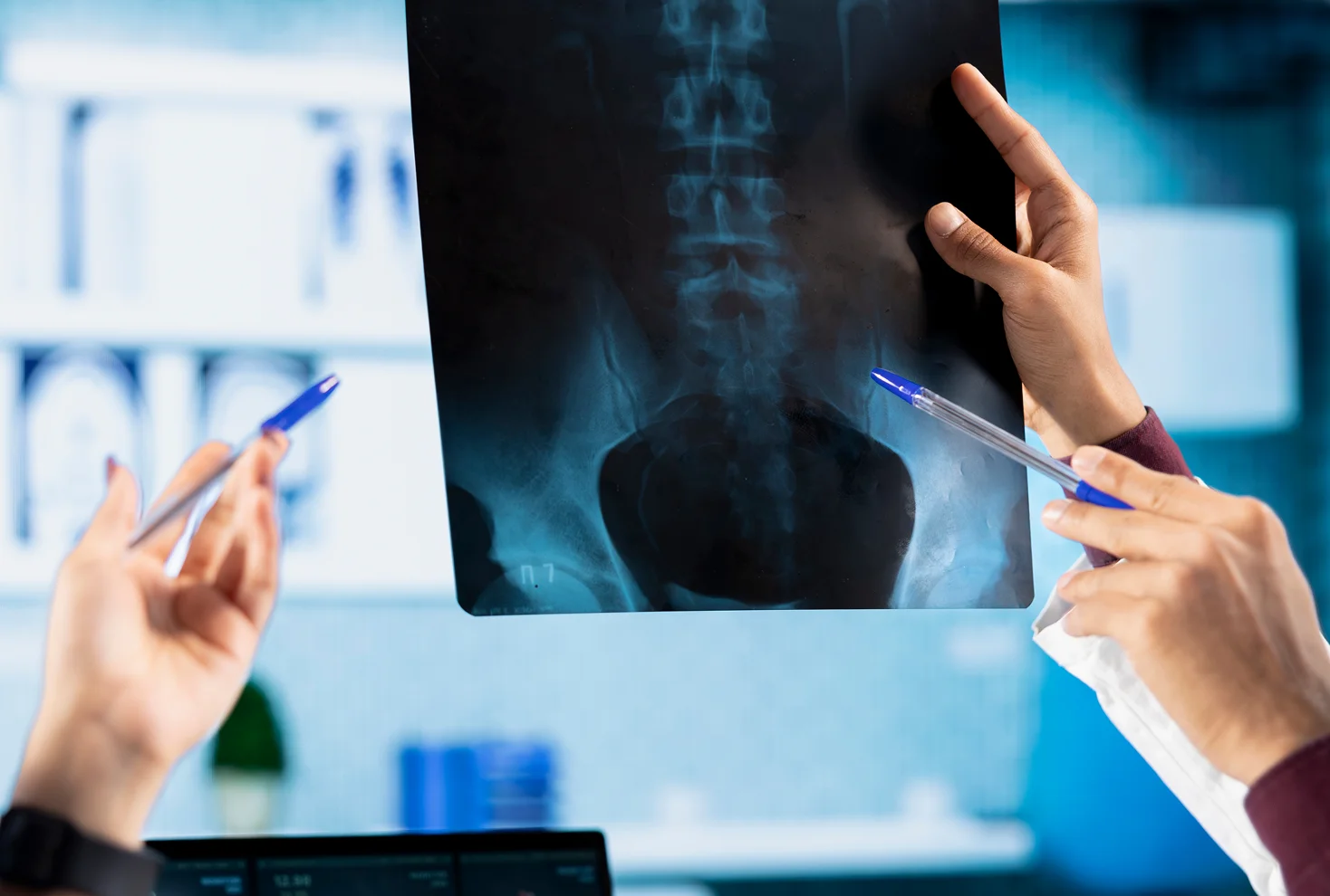 Compression Fractures & Degenerative Disc Disease