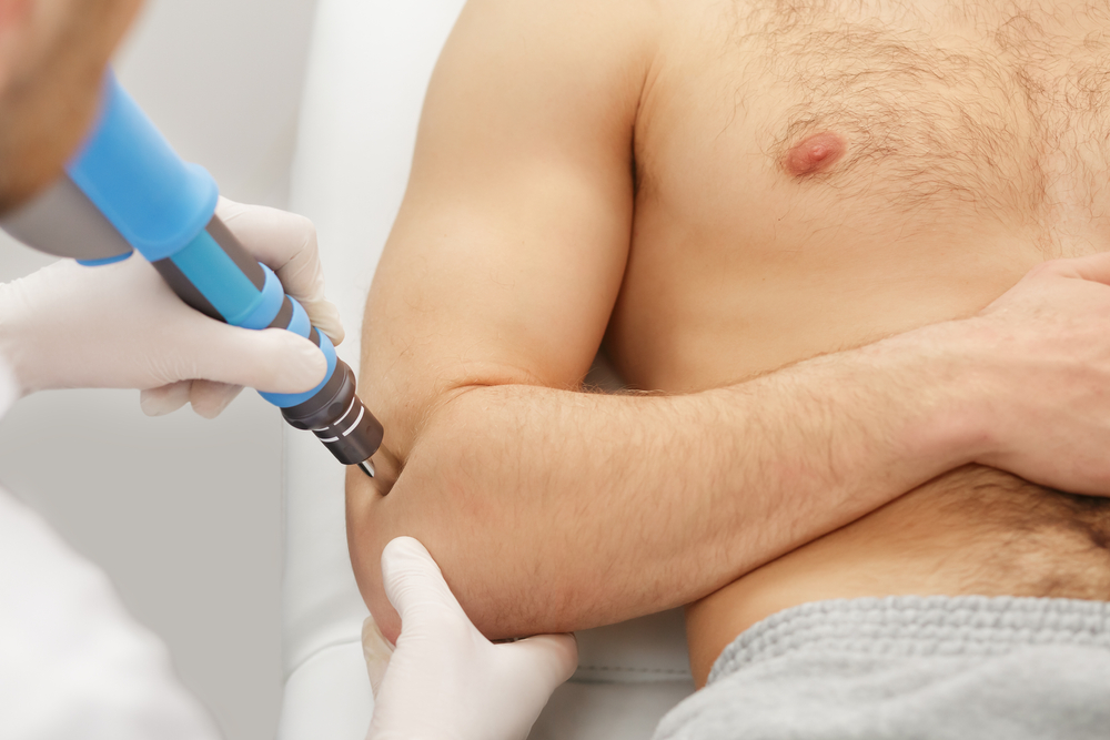 Extracorporeal Shockwave ESWT Therapy