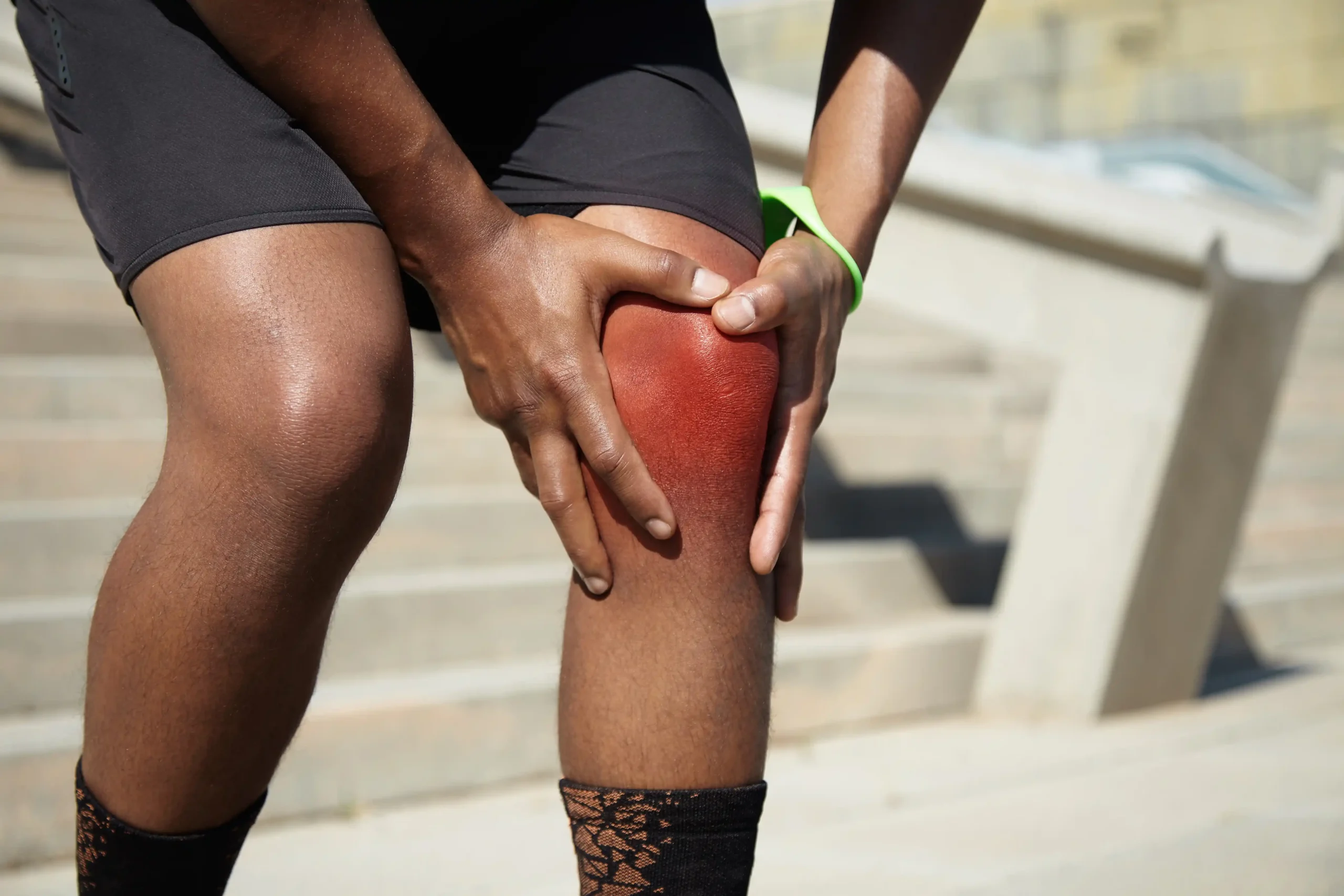 Runner experiencing runner’s knee pain during exercise