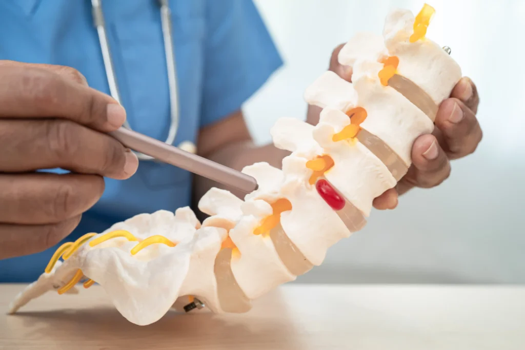 spine-model-illustration