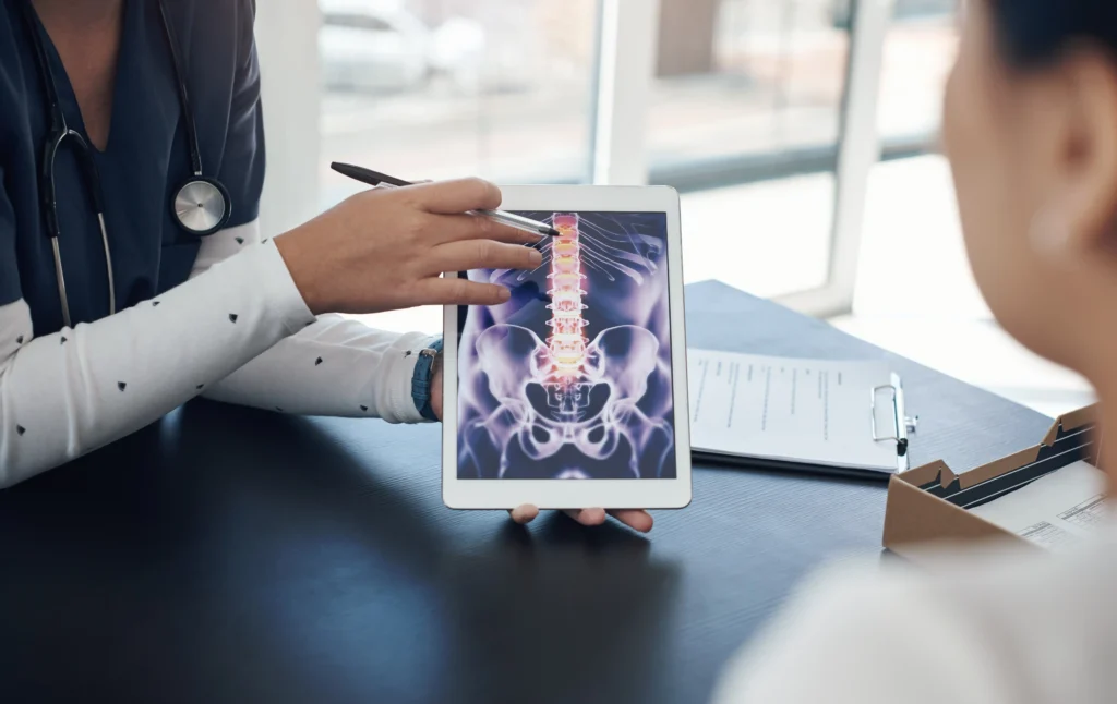 Doctor reviewing spinal MRI to assess a bulging disc