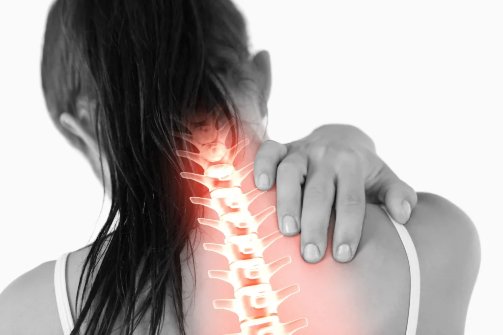 Illustration showing cervicogenic dizziness and cervical spine